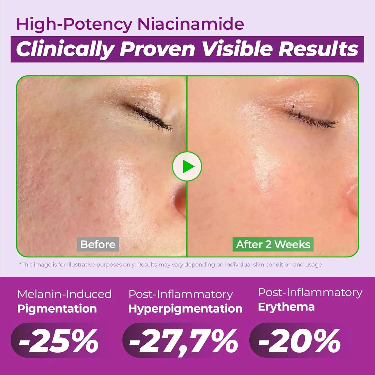 Сыворотка Jumiso — Корейская для лица Niacinamide Serum 20 с глутатионом — фото 3