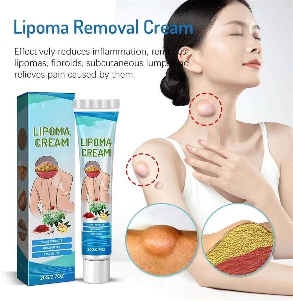 Крем для удаления липом от Lumpfree Cream (2 шт.) Xbaking, 2 Pieces. — фото 3