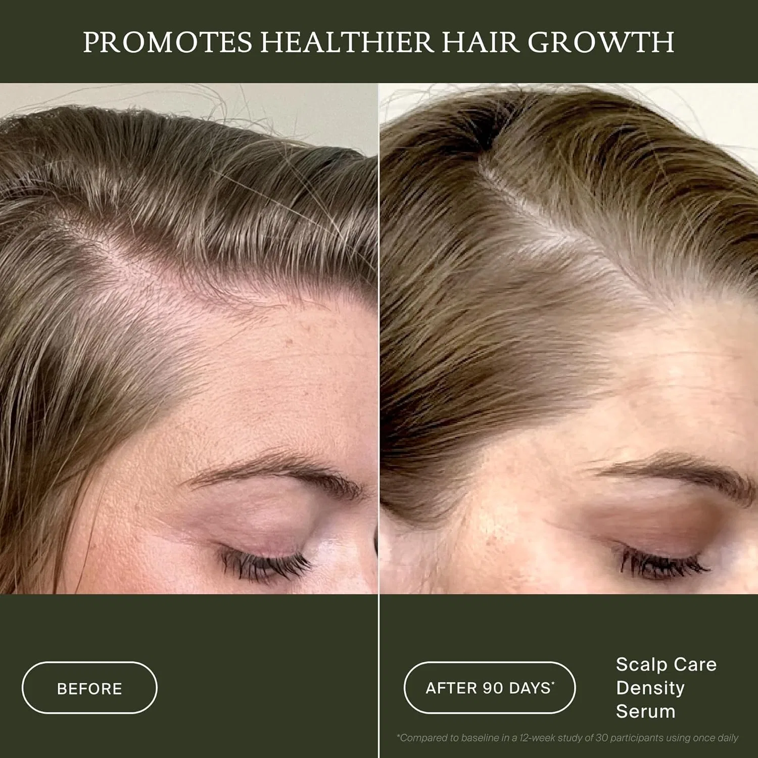 Сыворотка для кожи головы Living Proof Scalp Care Density Serum Living Proof — фото 3