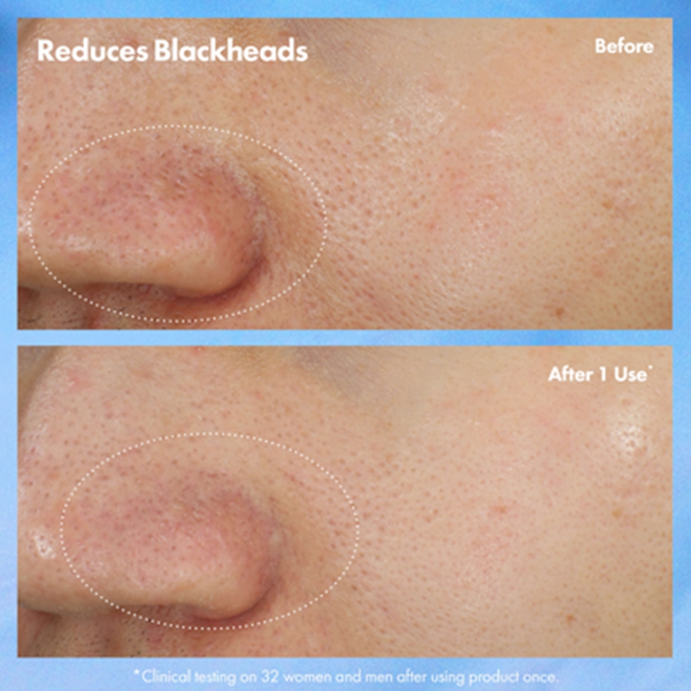 Маска для лица Origins — Для очищения пор Clear Improvement Blackhead Clearing Mask от черных точек, 75 мл — фото 4