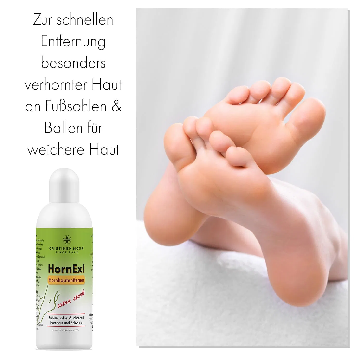 Набор для удаления мозолей «HornEx! Callus Remover Liquid» от Cristinen Moor ‎Cristinenmoor — фото 2