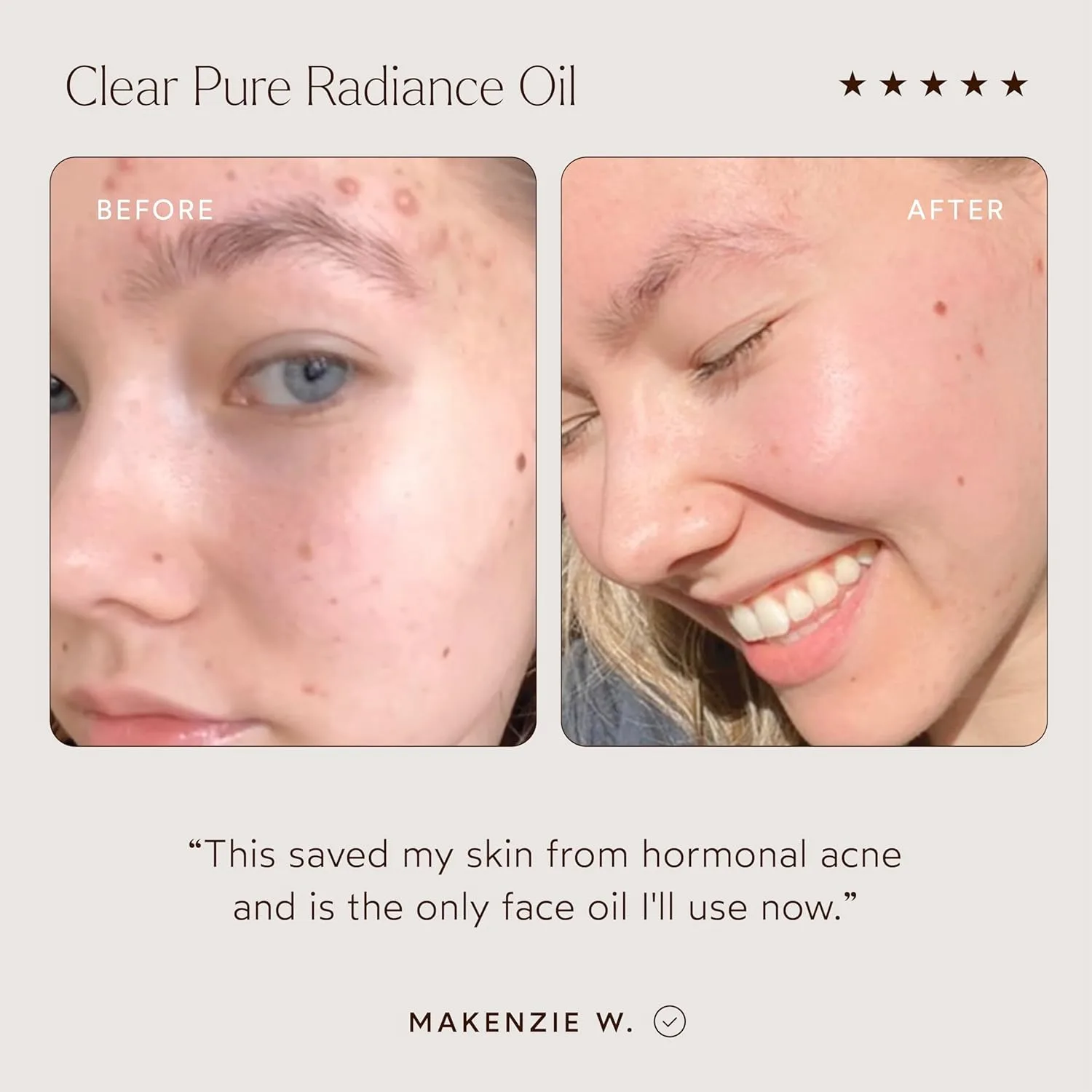True Botanicals Clear Pure Radiance Oil для жирной кожи, антивозрастное масло для лица, склонного к акне, против морщин, 30 мл — фото 3