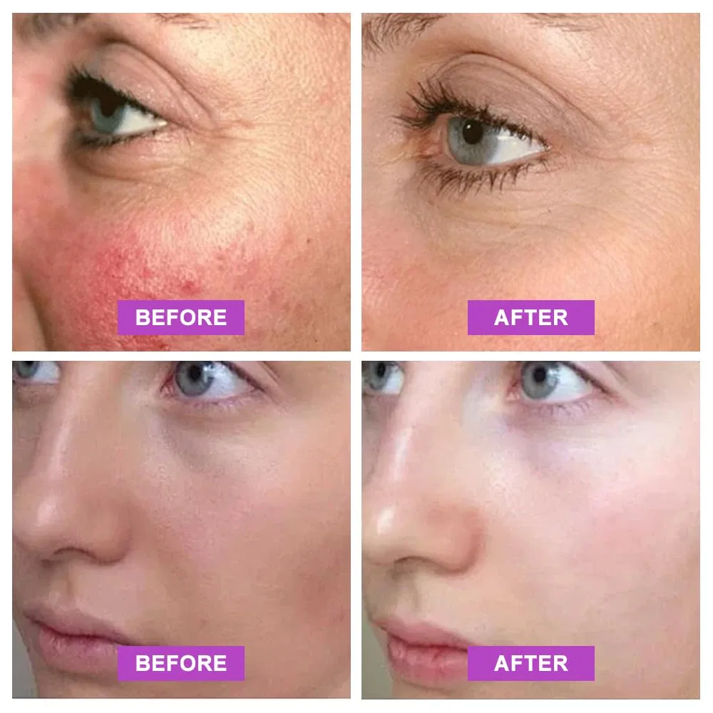 Солнцезащитный крем для тела SPF 100+, 80 г Kuirunrx — фото 3