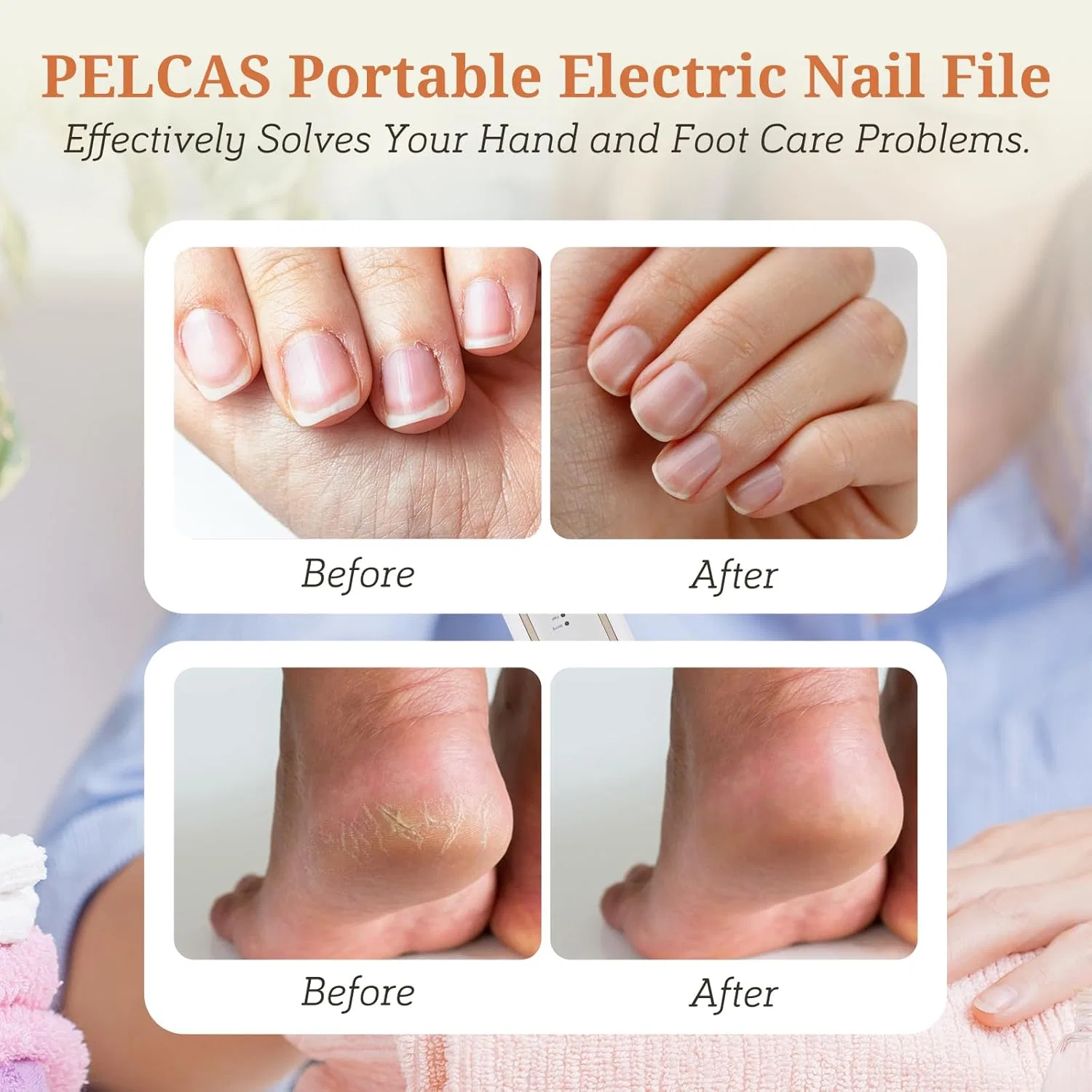 Беспроводная пилка для ногтей «Nail Cutter» от PELCAS Pelcas, White Gold — фото 2