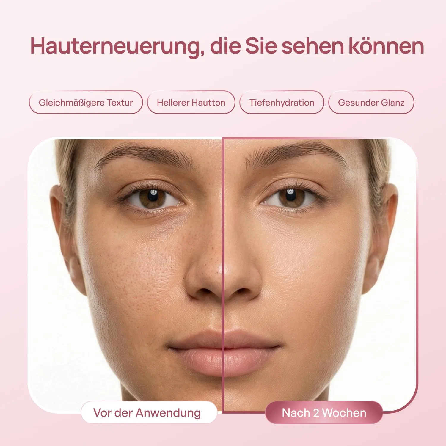 Сыворотка Plantifique — Корейская для лица PDRN Exosome Reedle Shot Serum 1500 PPM — фото 2