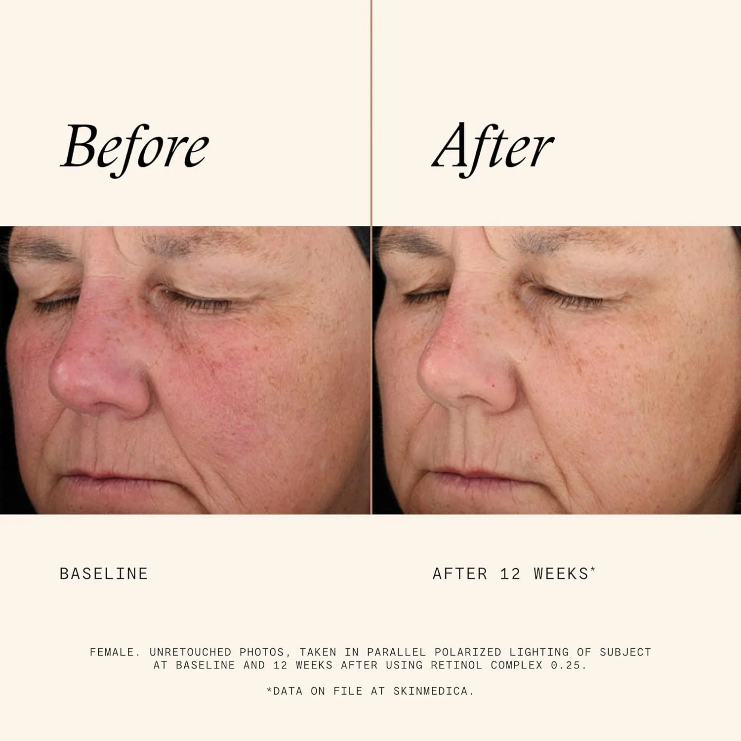 Крем для лица Skinmedica — Ретинол — фото 4