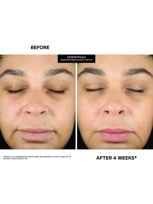 Сыворотка Kate Somerville — Омолаживающая KateCeuticals SuperCell, 30 мл — фото 4