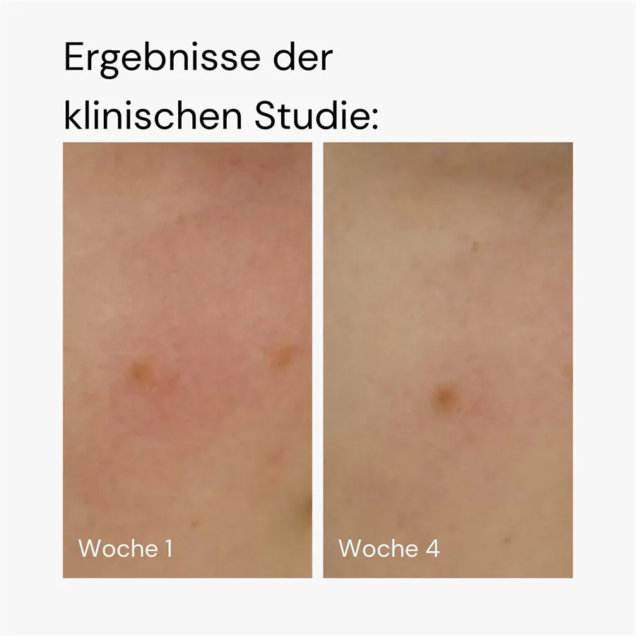 Сыворотка MERME Berlin — Увлажняющая для лица, дополнительное увлажнение, 30 мл — фото 3