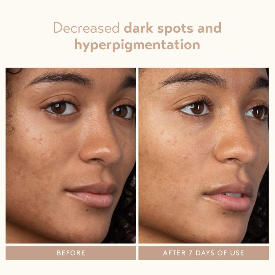 Сыворотка Shani Darden Skin Care — Отшелушивающая с молочной кислотой и AHA-кислотами, 30 мл — фото 4