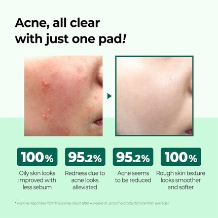 Тоник Some By Mi — AHA BHA PHA 30 Days Miracle Truecica Clear Pad 70 подушечек - корейский уход за кожей, 125 мл — фото 3