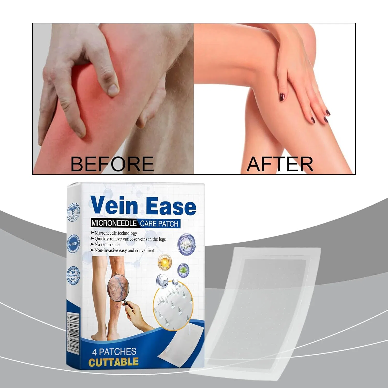 Пластыри Vein Ease Microdarts для лечения варикозного расширения вен Generic, 3Pcs — фото 2