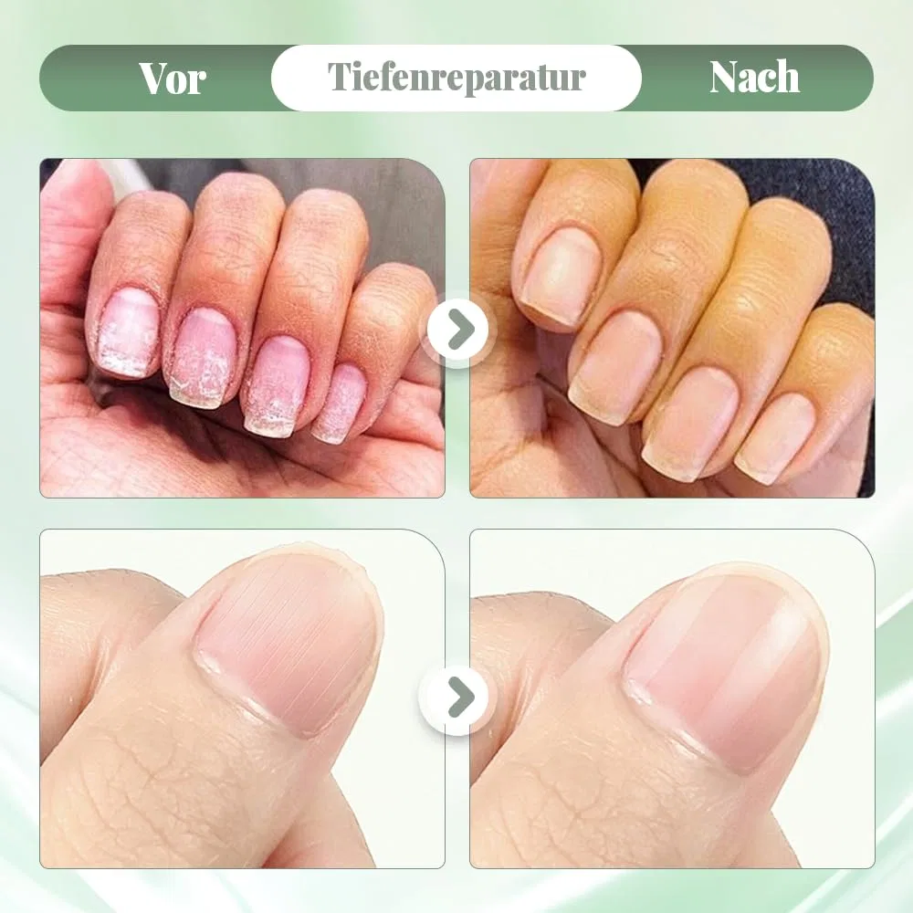 Карандаш для ухода за ногтями от грибка (3 шт.) Cosen, 3Pc — фото 4