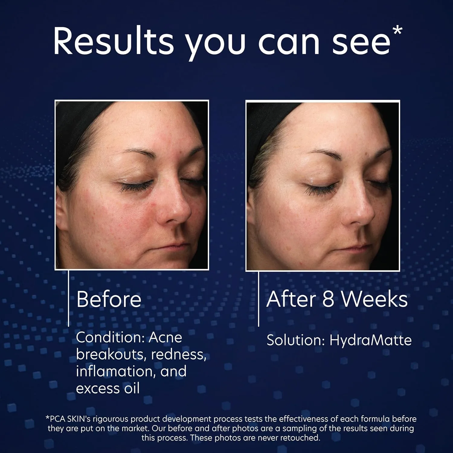 PCA SKIN HydraMatte увлажняющий крем для контроля жирности, для жирной кожи, уменьшает блеск и выравнивает тон, быстро впитывается, для комбинированной и жирной кожи, 51 г — фото 4