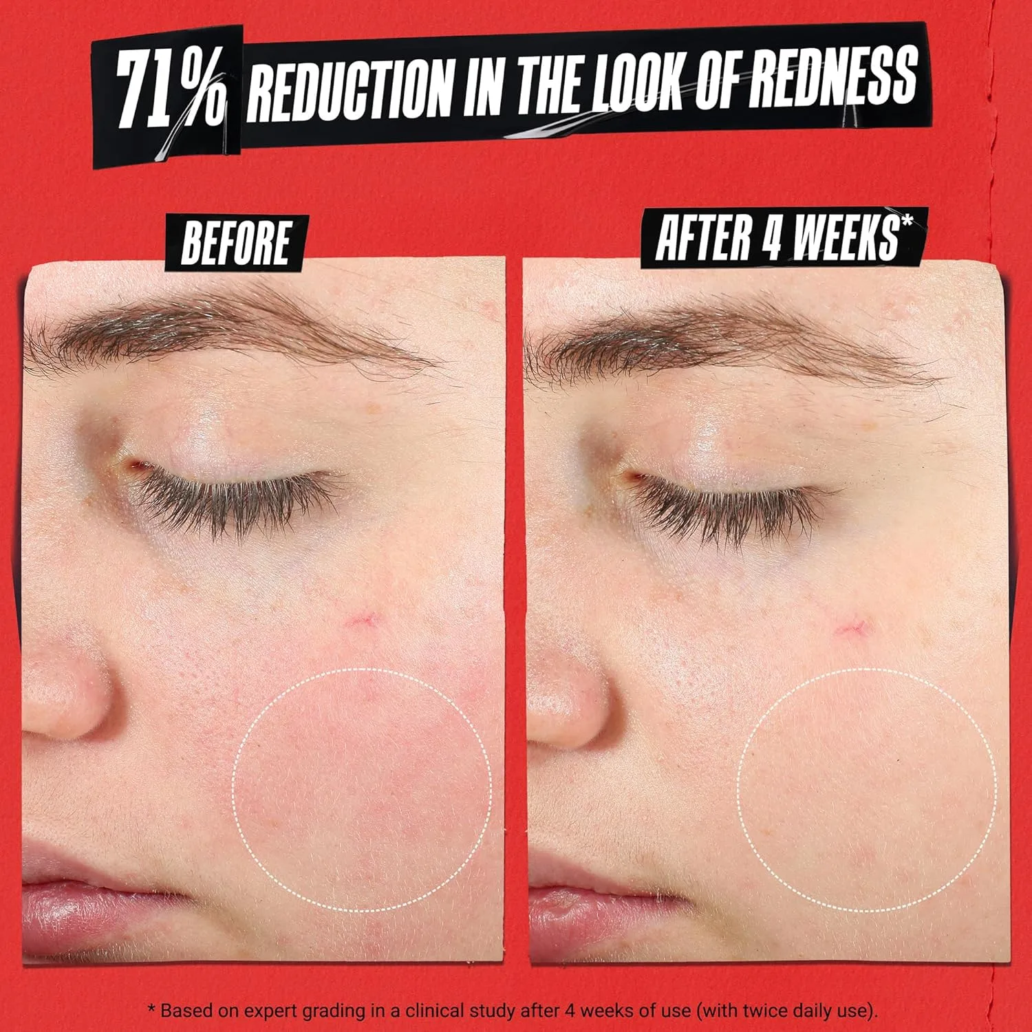 Крем для лица Kiehl's — Ultra Facial Recovery Barrier Cream, легкий увлажняющий , восстанавливает и укрепляет, 50 мл — фото 2