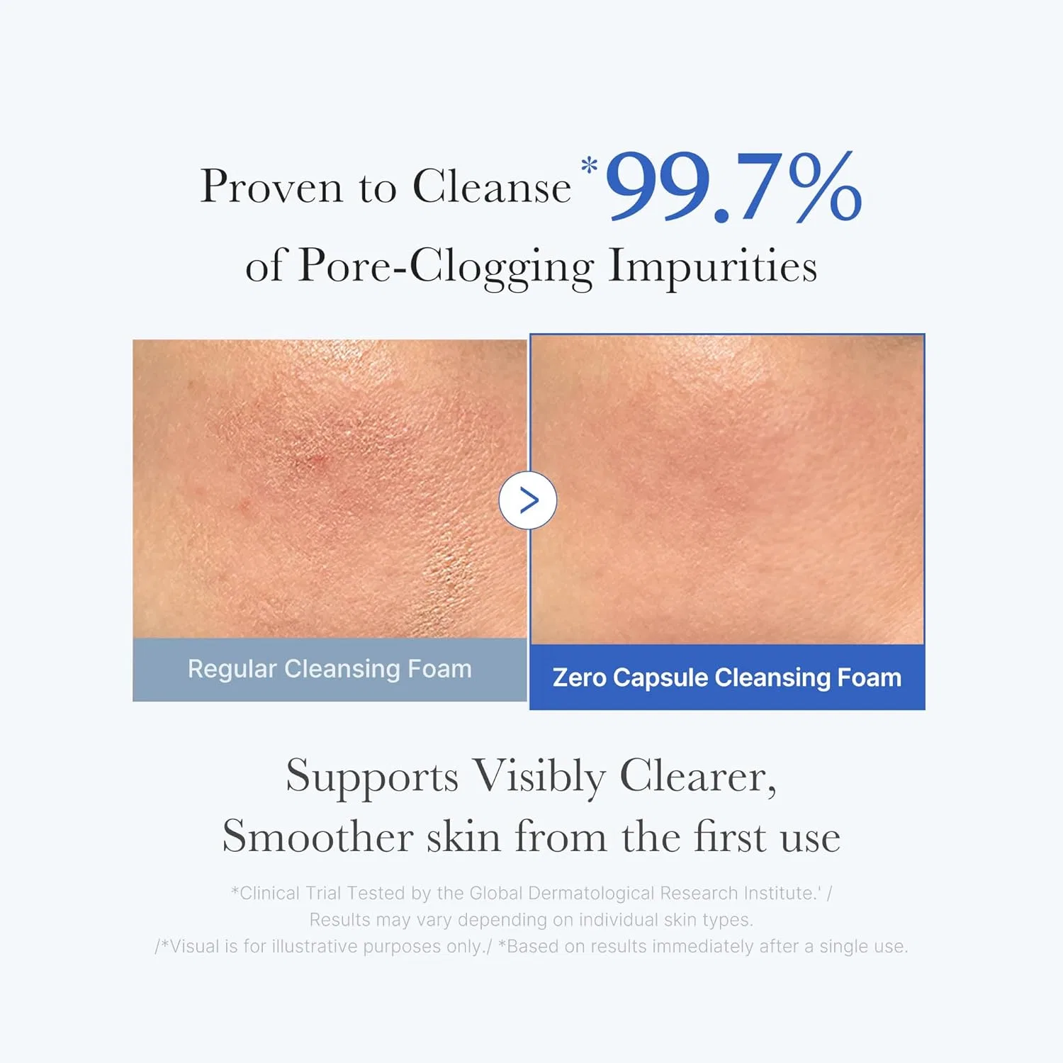 Крем для лица Medicube — Нежное очищающее средство «Zero Pore Clear Blue Capsule Cleanser» от, 120 г — фото 3