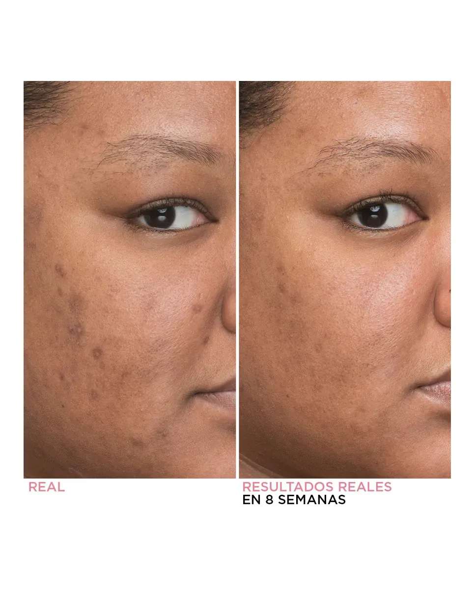 Минимизатор темных пятен Bye Bye Dark Spots Концентрированная сыворотка для лица 30 мл It Cosmetics — фото 3