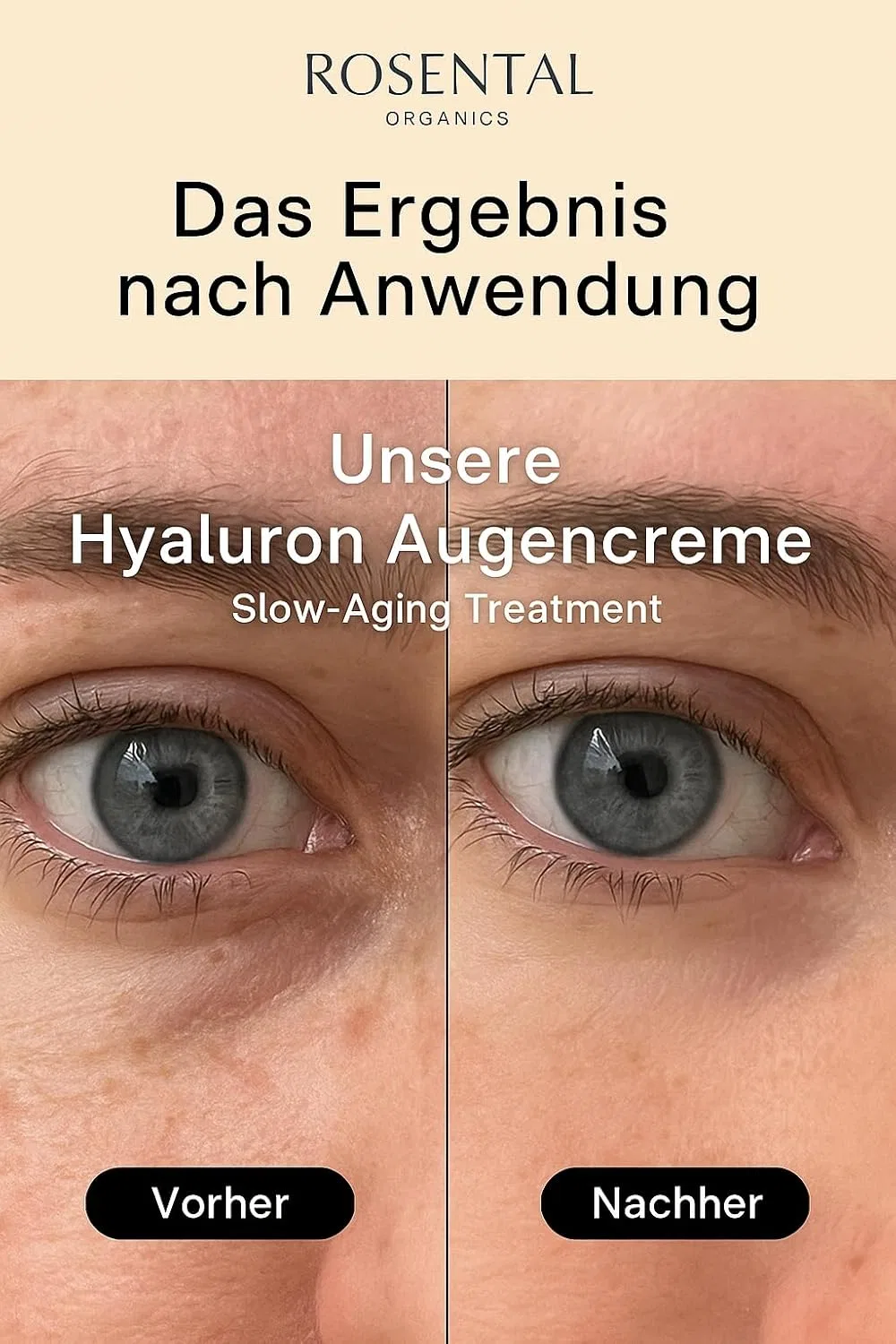 Гиалуроновый бальзам для глаз Rosental Organics Hyaluronic Eye Balm Rosental — фото 4