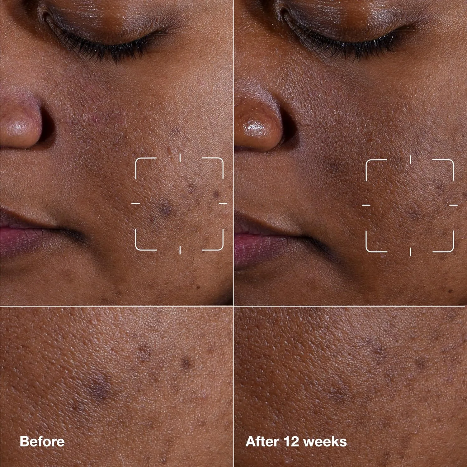 Сыворотка Clinique — Для лица Even Better Clinical для осветления пигментных пятен с витамином С для всех — фото 2