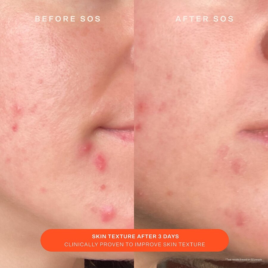 Сыворотка Tower 28 Beauty — Увлажняющий SOS Daily Skin Barberry Redness Recovery Moisturizer для ежедневного, 55 мл — фото 3