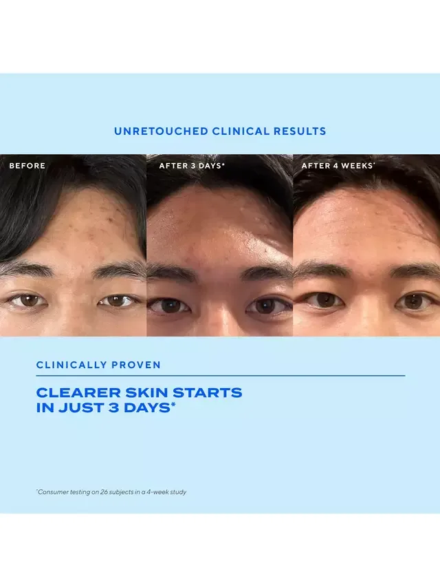 Сыворотка Murad — Для контроля и предотвращения появления прыщей Blemish Control Biome-Balancing Clear &, 30 мл — фото 4