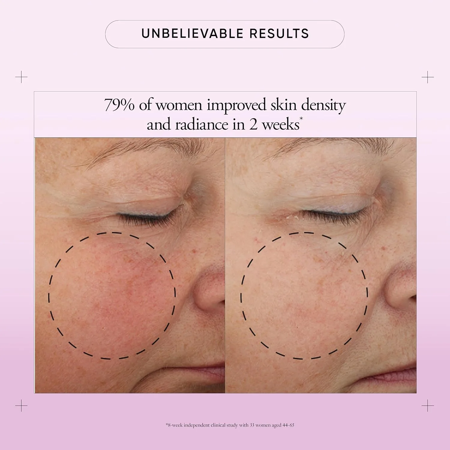 Крем для лица SPF30 PHILOSOPHY Ultimate miracle worker увлажняющий с и инкапсулированным ретинолом для упругой и — фото 2