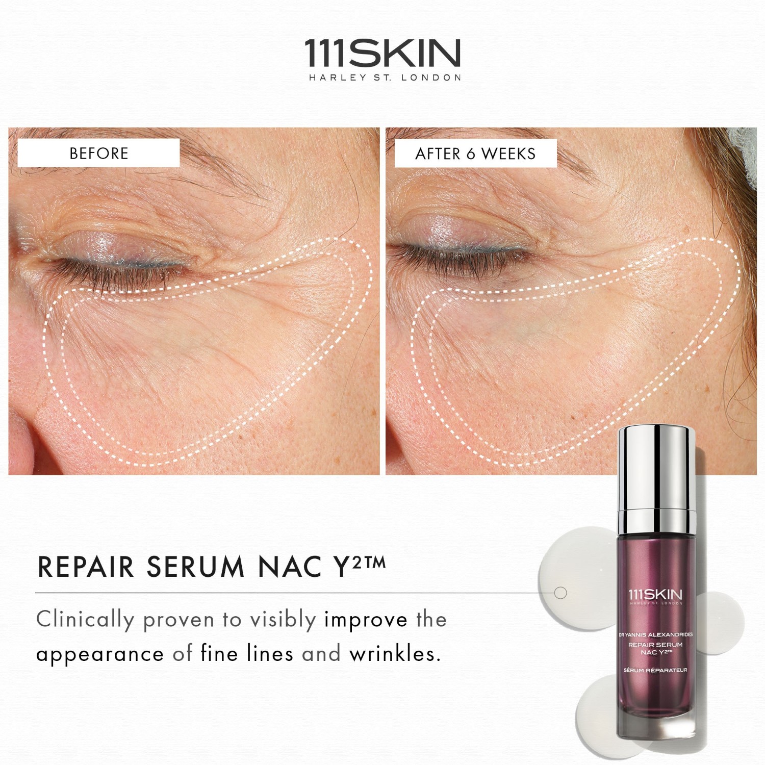 Сыворотка для лица nac y² repair serum nac y2 111Skin, объем 30 мл — фото 4
