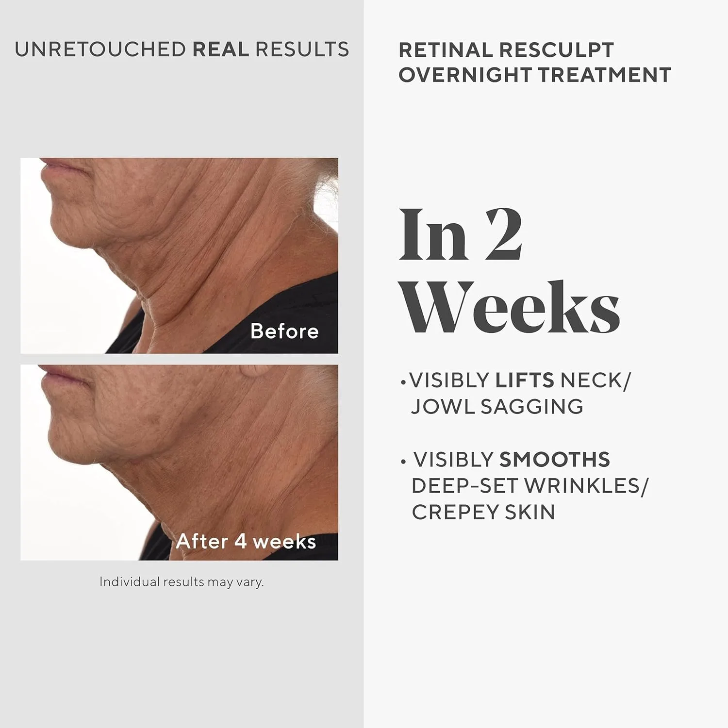 Murad Retinal ReSculptors - набор из 2 полноразмерных средств ($197) - сыворотка и крем для глаз с 2,5x витамином A, лифтинг, упругость, антивозрастной уход, инкапсулированный ретинал, уменьшение морщин на лице, глазах и шее — фото 4