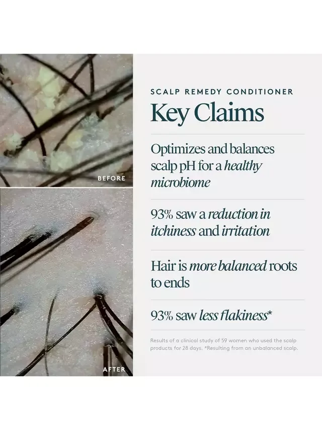 Кондиционер для кожи головы Scalp Remedy, 200 мл Virtue — фото 3