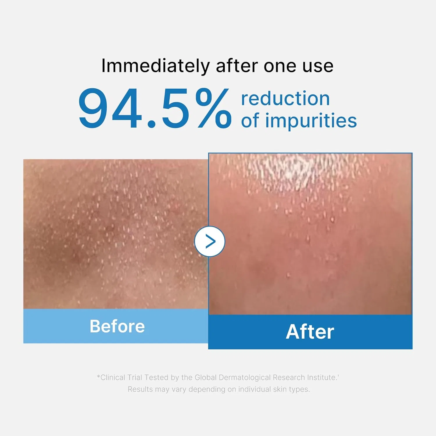 Гидрофильное масло Medicube — «Zero Pore Blackhead Cleansing Oil» от, 205 мл — фото 2