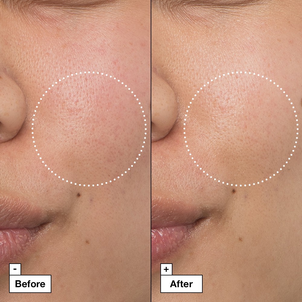 Крем для лица Dr. Jart+ — Cicapair intensive soothing repair cream Dr Jart, объем, 50 мл — фото 3