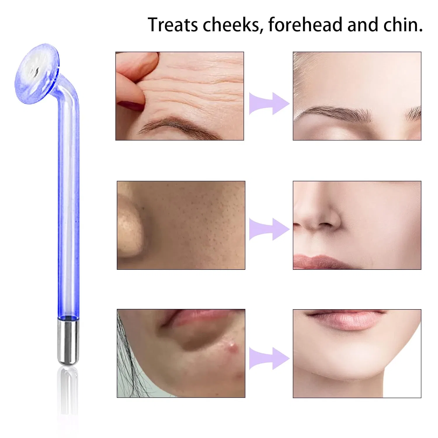 Стеклянный электрод для дарсонваля грибок фиолетовый от Beauty Parts Elitzia — фото 2