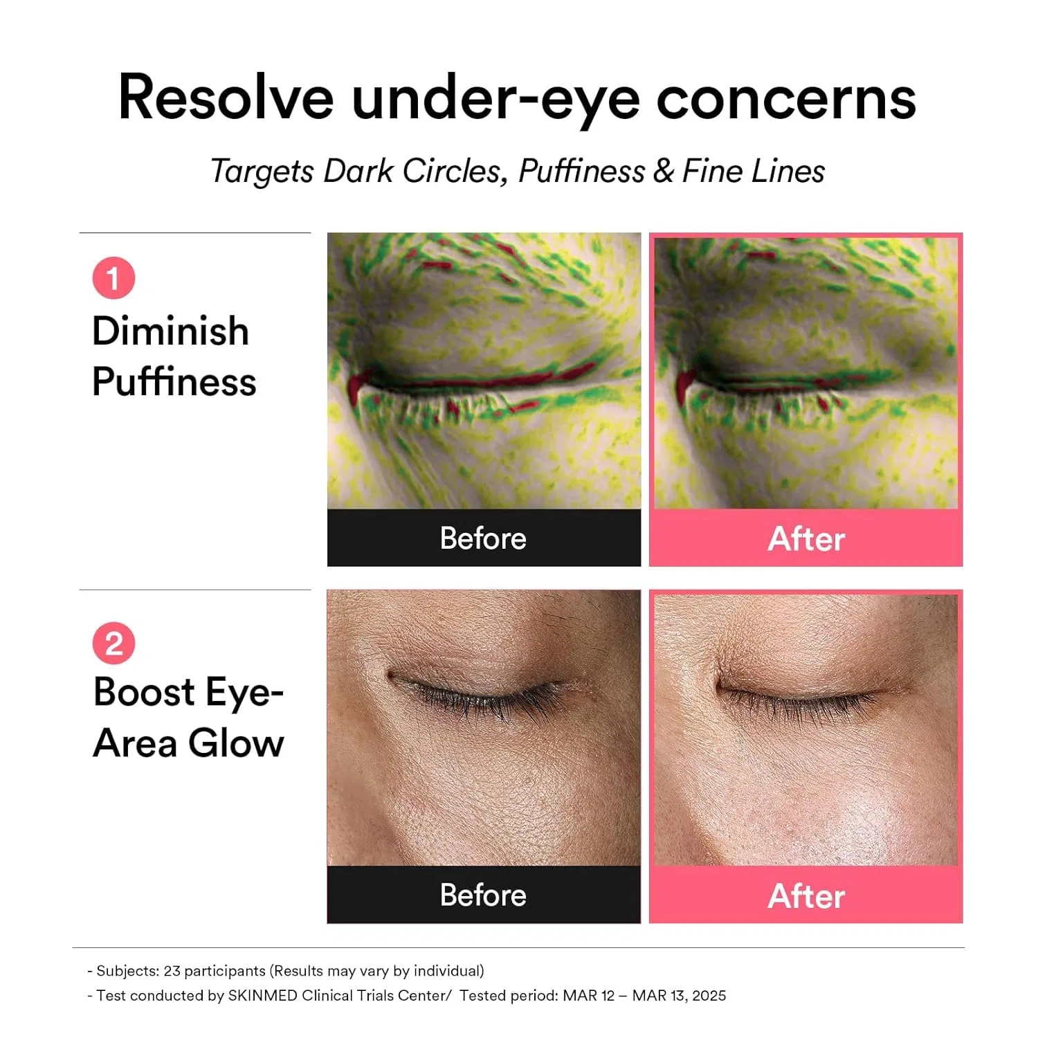 Корейские патчи для глаз «Pdrn Retinal Eye Patch Glow Jelly» от Abib Abib, Pdrn — фото 4