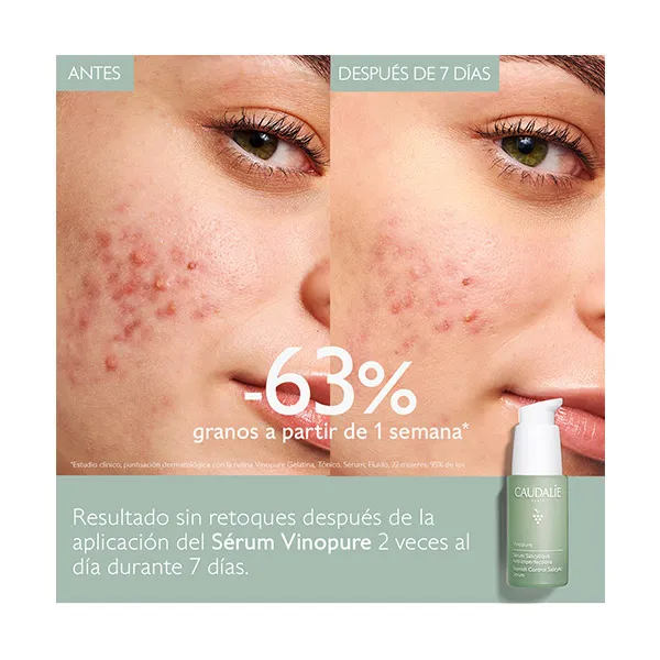 Сыворотка Caudalie — Салициловая против несовершенств Vinopure, 30 мл — фото 2