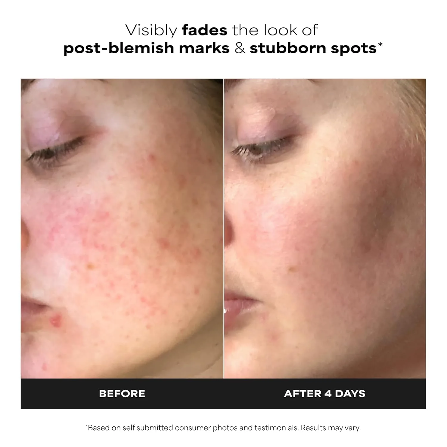 Бустер Paula's Choice — BOOST % Azelaic Acid Booster Cream Gel Face Serum with Salicylic Acid, Oil-Free Skin, 29.6 мл — фото 2