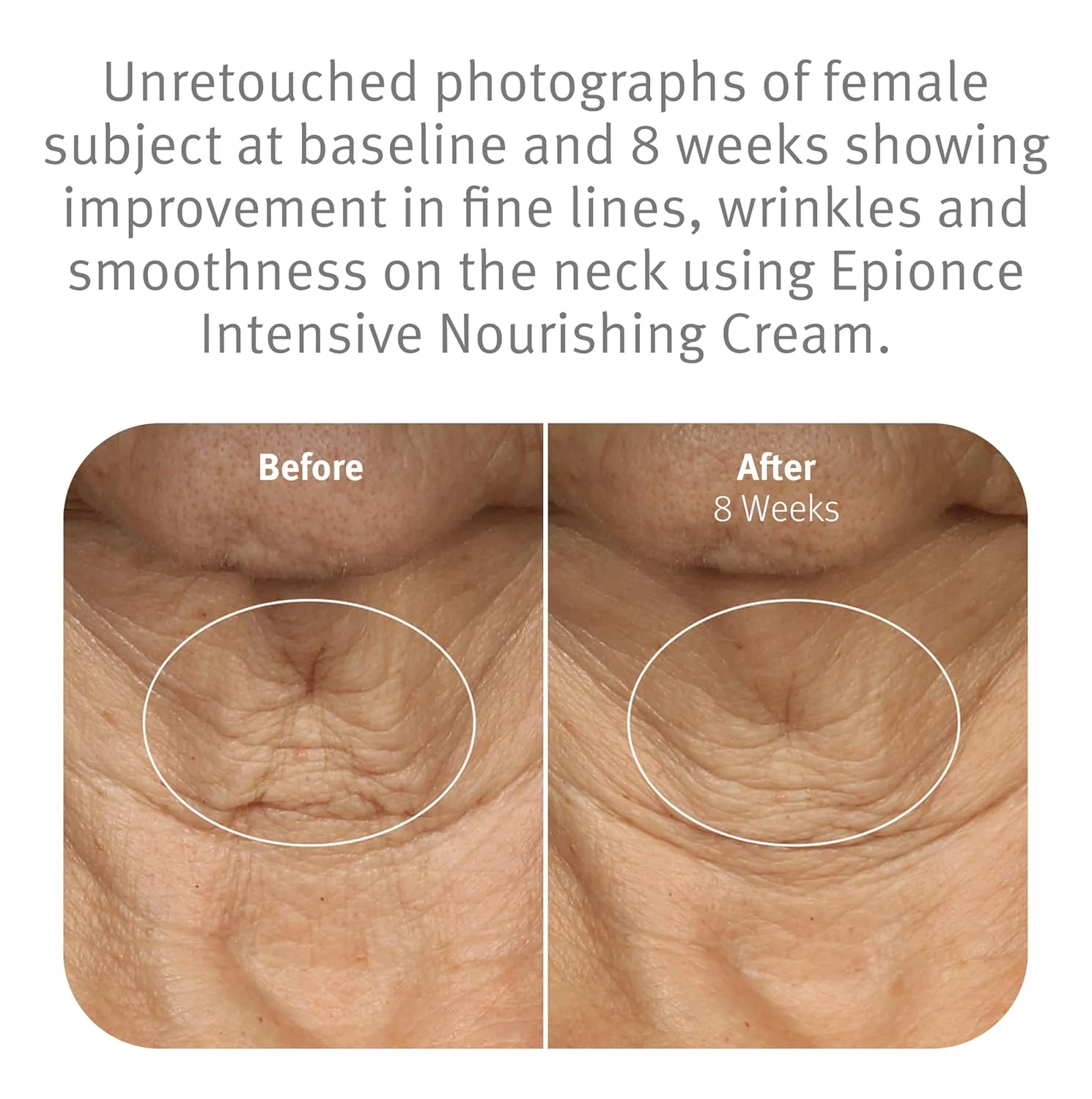 Крем для лица SPF EPIONCE Intensive Nourishing Cream - интенсивный питательный против старения для лица, шеи и — фото 4