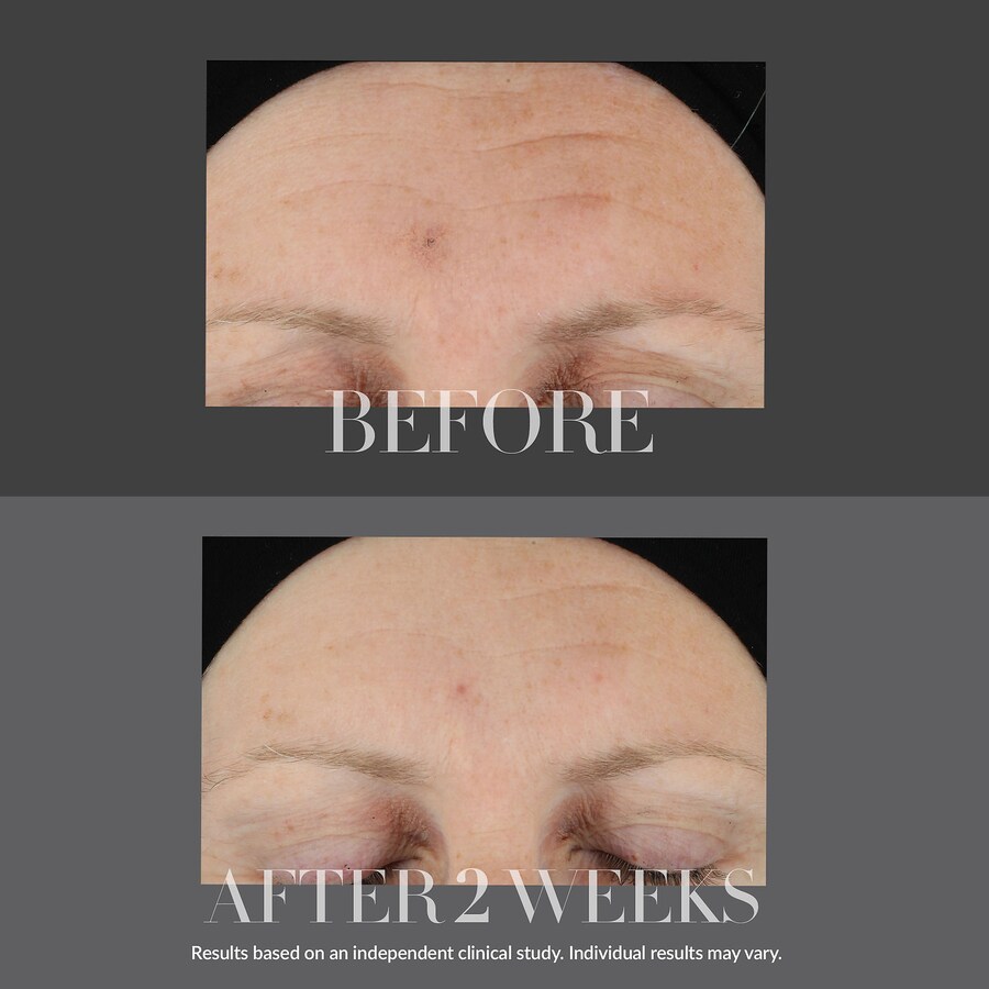 Укрепляющая сыворотка с гиалуроновой кислотой от KateCeuticals Kate Somerville, 1 oz/30 mL — фото 2
