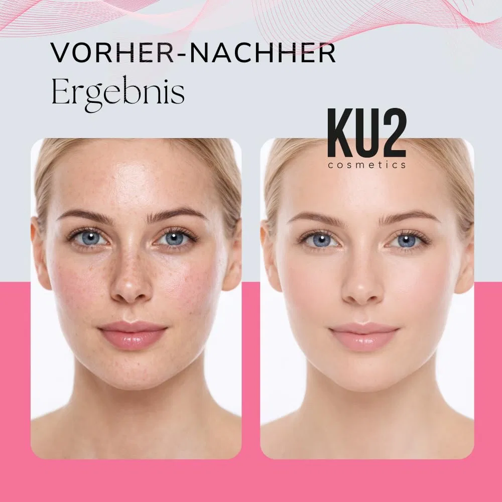 Сыворотка Ku2 Cosmetics — Для лица против покраснений Anti Red Ultra Sensitive, 30 мл — фото 4