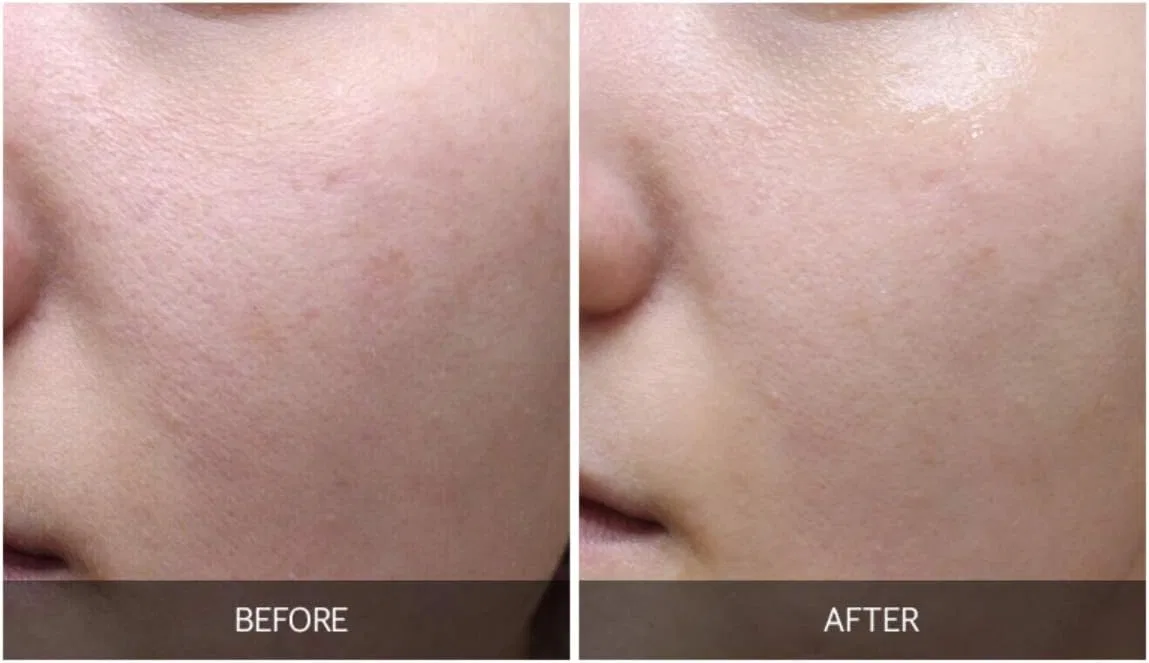 Тоник The Lab By Blanc Doux — Oligo Hyaluronic Acid, 200 мл — фото 2