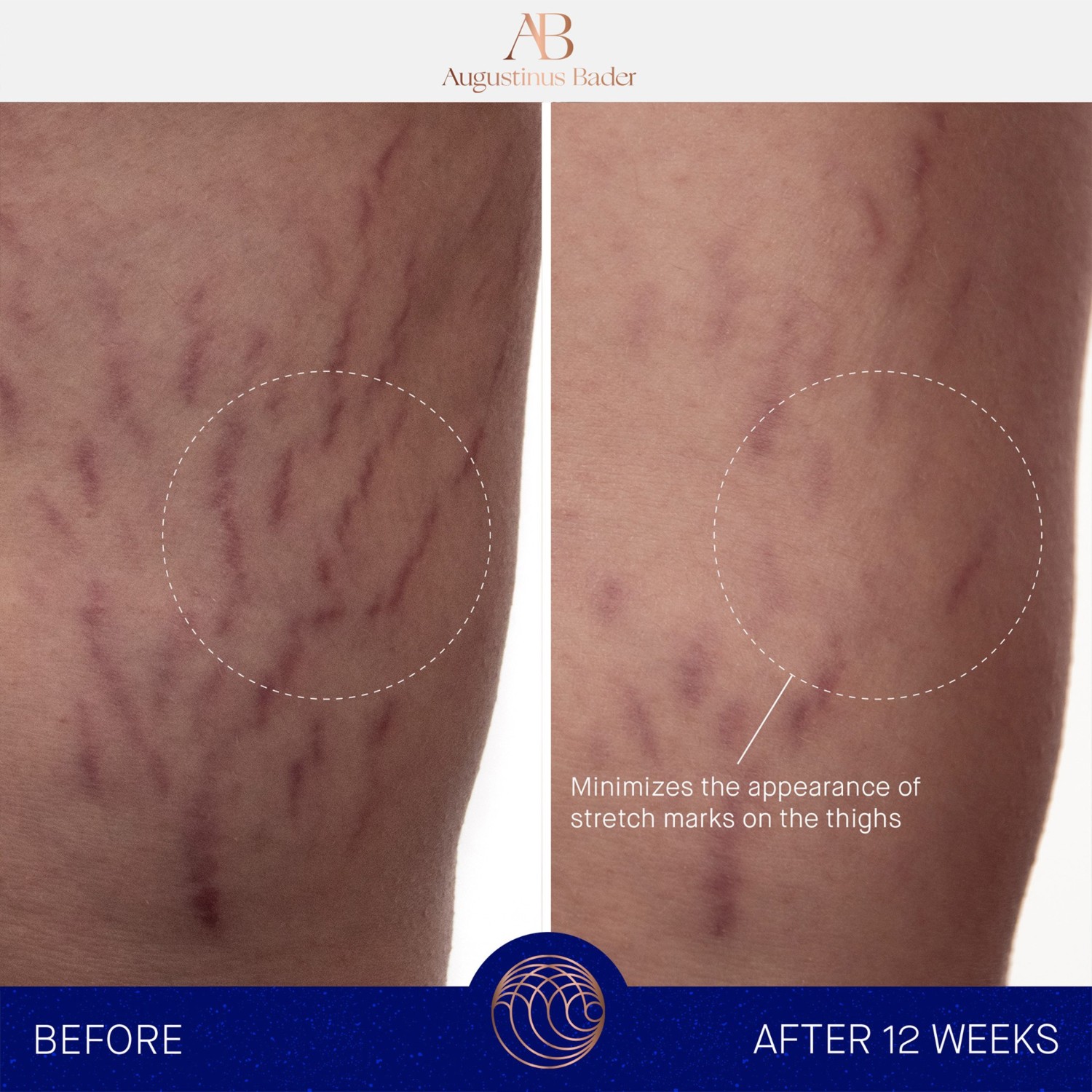 Крем для тела the body cream reformulated Augustinus Bader, объем 200 мл — фото 4