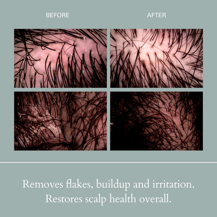 Солевой скраб для кожи головы, отшелушивающий детокс-шампунь с AHA и BHA кислотами. RŌZ, 6.8 fl oz/200 mL — фото 4