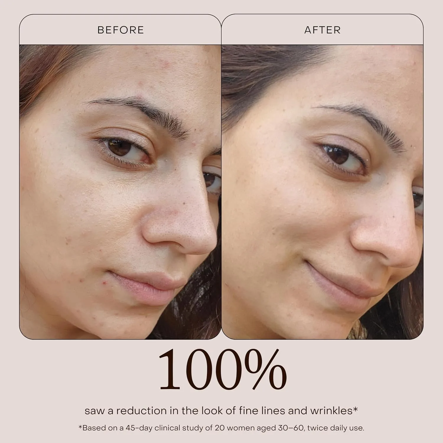 True Botanicals Renew Pure Radiance Oil антивозрастное масло для лица с шиповником 30 мл — фото 4