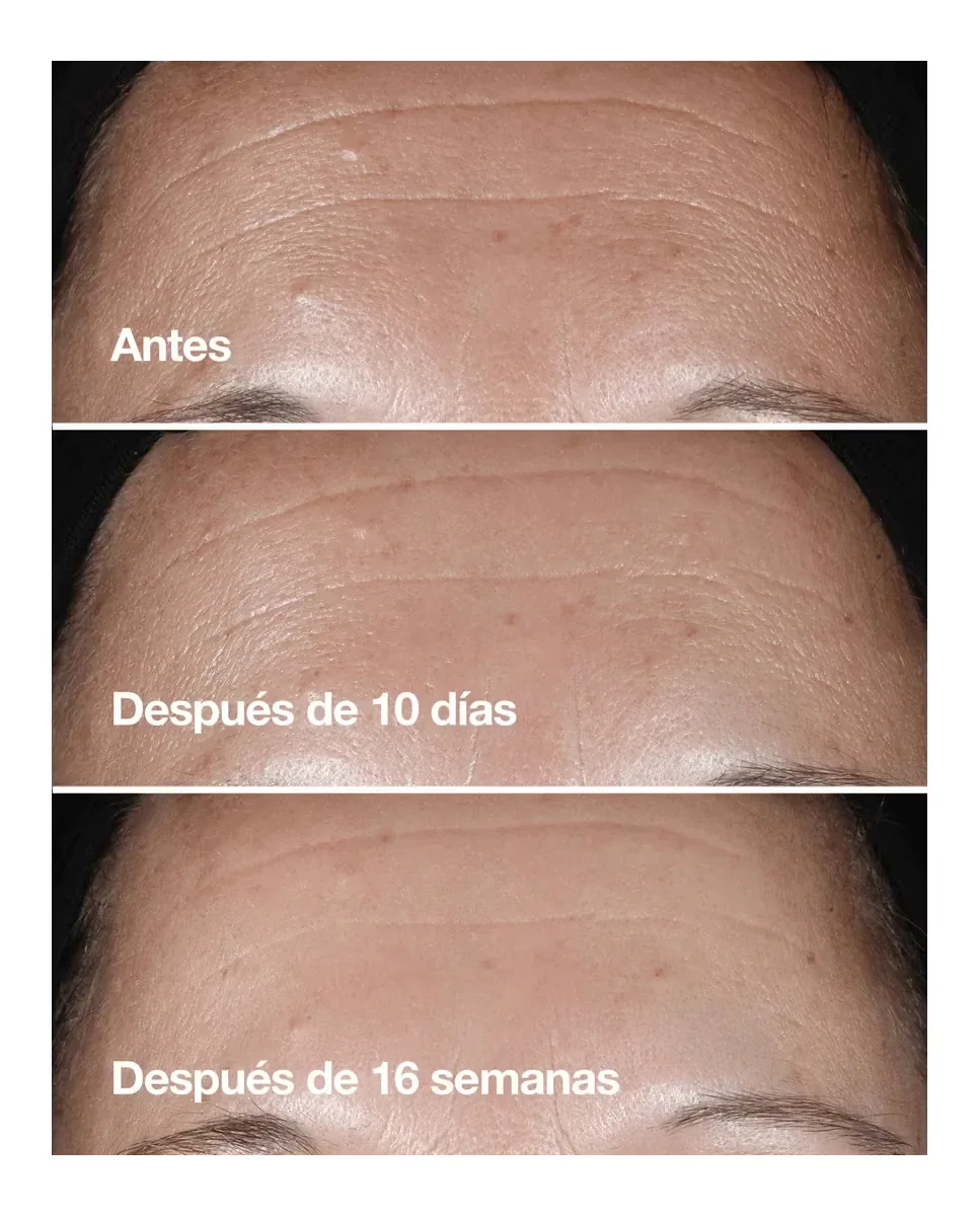 Сыворотка Clinique — Антивозрастная Smart Clinical Repair, 75 мл — фото 3