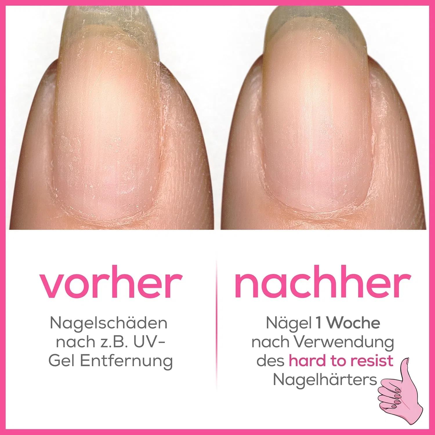 Укрепитель для ногтей «Hard to Resist Pink Ink» от essie Essie, Pink / San Diego — фото 4
