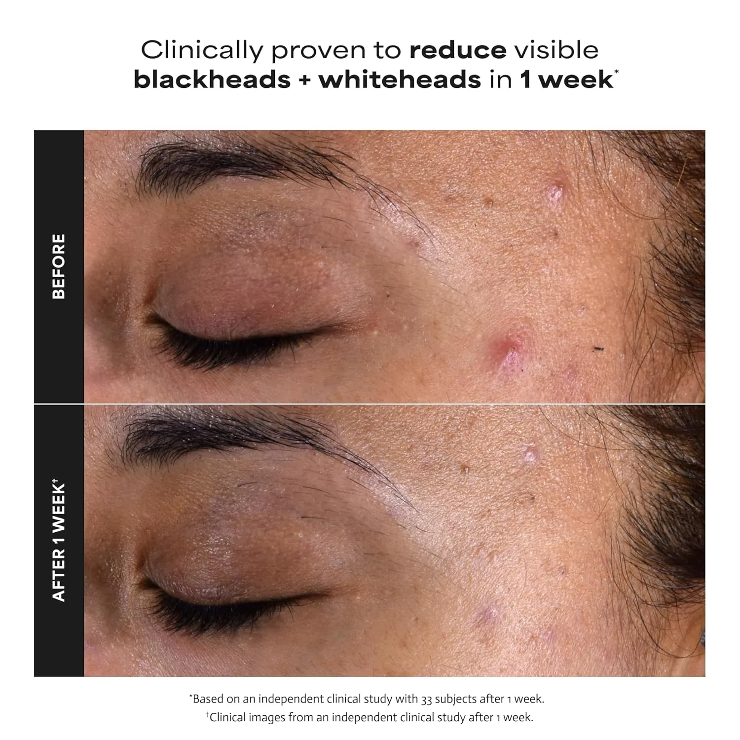 Paula's Choice SKIN PERFECTING 2% BHA жидкий эксфолиант с салициловой кислотой для пор, морщин и черных точек, без отдушки 29,6 мл — фото 4