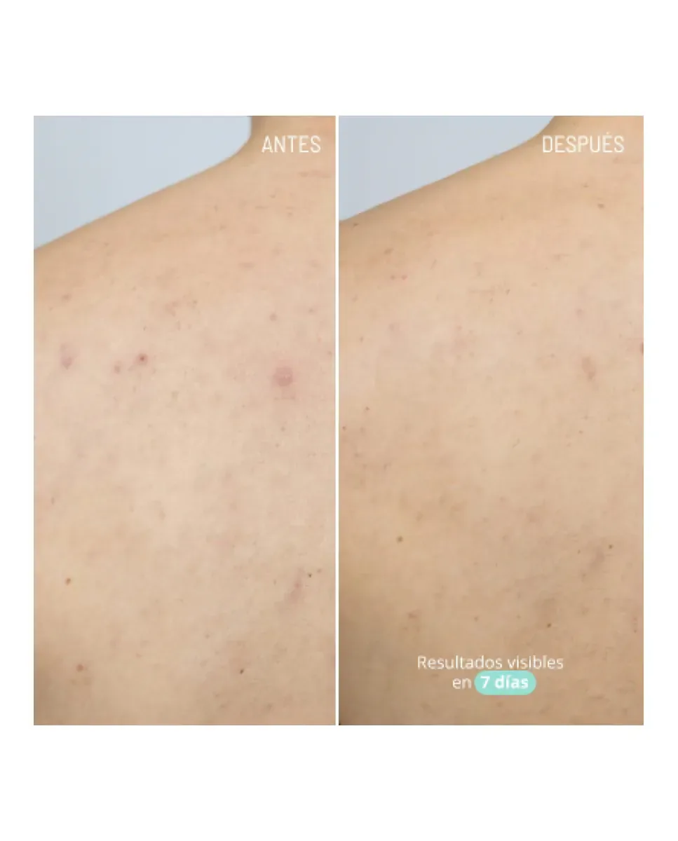 Крем для лица Freshly Cosmetics — Гель для тела с активным азелаином, 100 мл — фото 3
