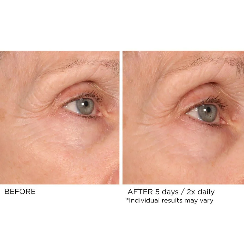 Сыворотка для обновления кожи вокруг глаз NASSIFMD Age Defying Eye Renewal Serum - двойное действие, пептидное осветление, борьба с морщинами, отечностью и темными кругами. — фото 4