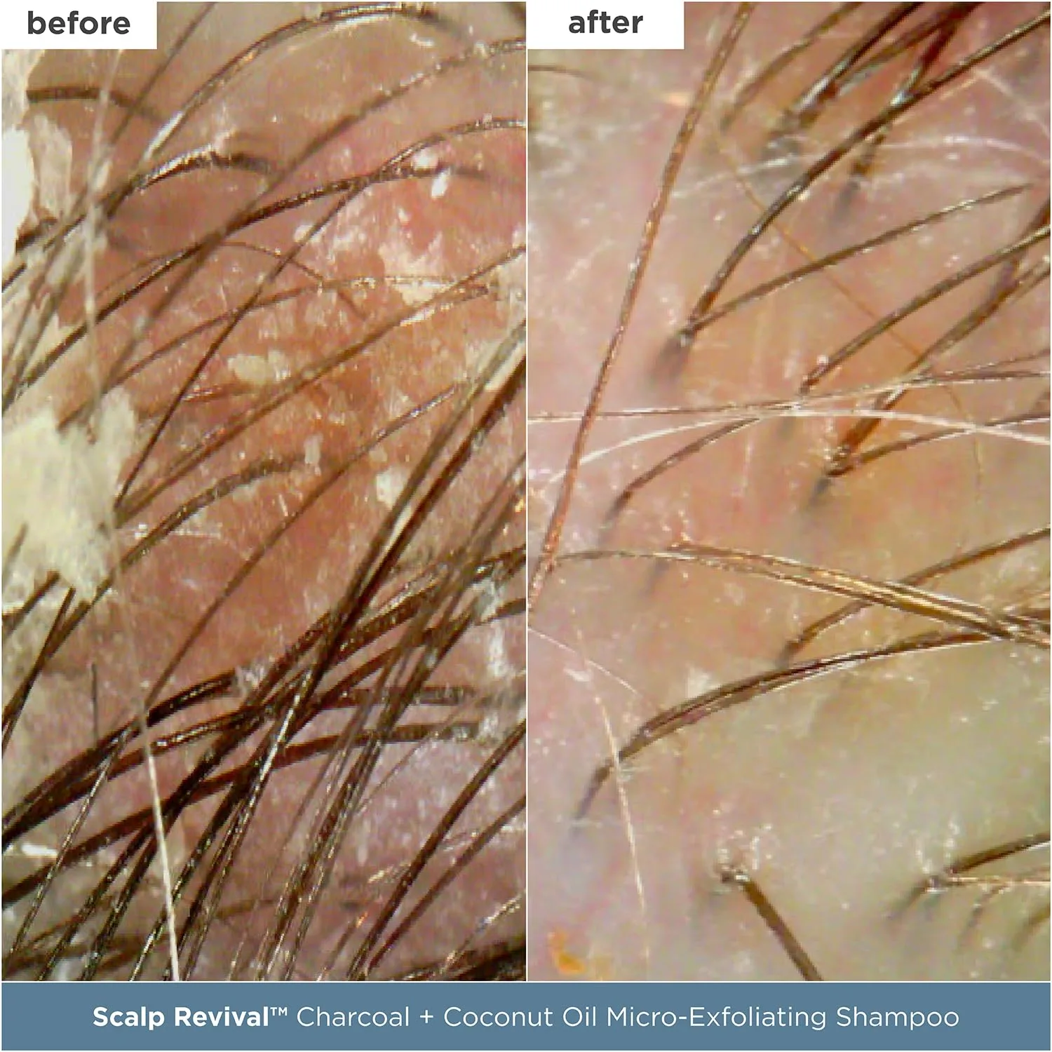 Набор для ухода за кожей головы Briogeo Scalp Revival: детокс и увлажнение с углем и маслом чайного дерева, веганский, без жестокости 1 шт. — фото 2