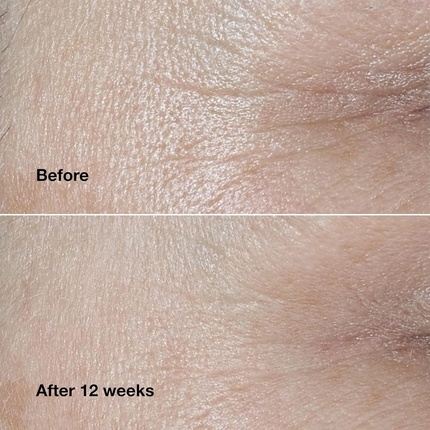 Крем для лица Clinique — Smart Clinical Repair Wrinkle Correcting .5 Ounce — фото 3