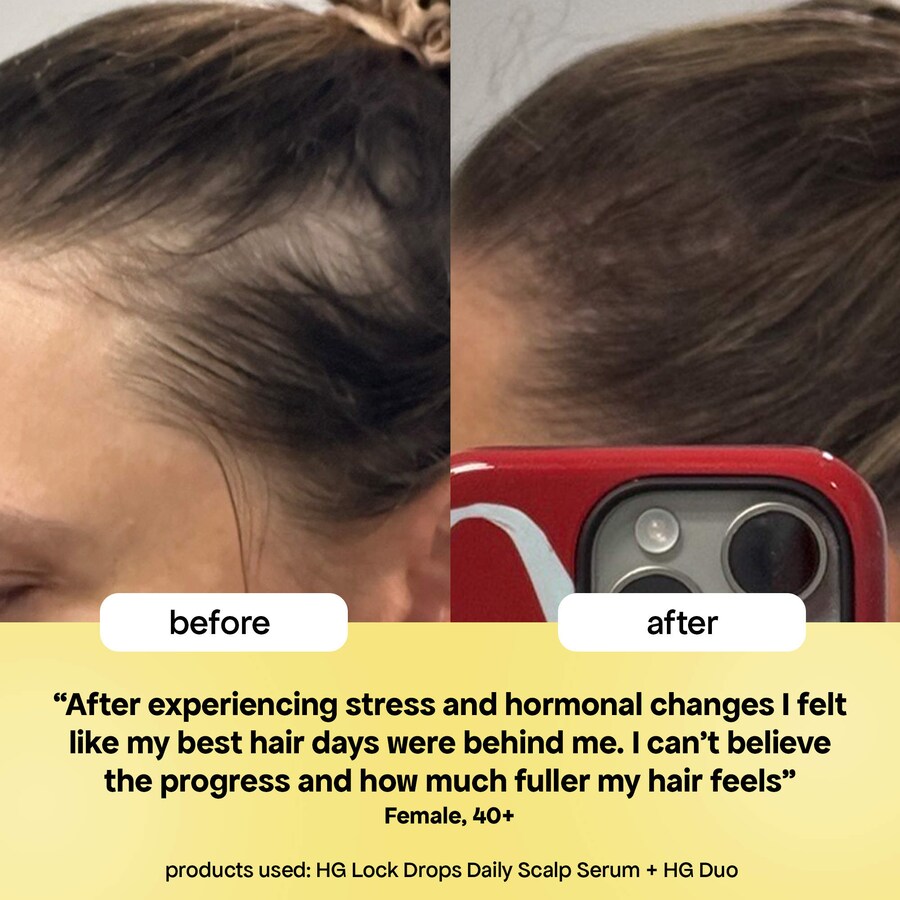 Сыворотка для волос HG Lock Drops Daily Hair Serum с розмарином для тонких волос BondiBoost, 1 oz/30 ml — фото 3