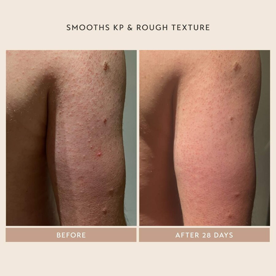 Сыворотка Shani Darden Skin Care — Для тела Body Reform Treatment Serum с % гранулятивным ретиноидом, 120 мл — фото 3